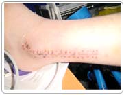 ankle2